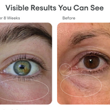 Eye Serum