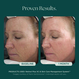 Retinol Plus XC
